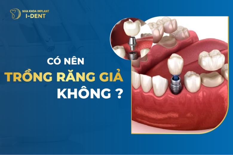 Có Nên Trồng Răng Giả Không?