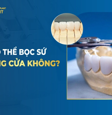 Có Thể Bọc Sứ 4 Răng Cửa Không?