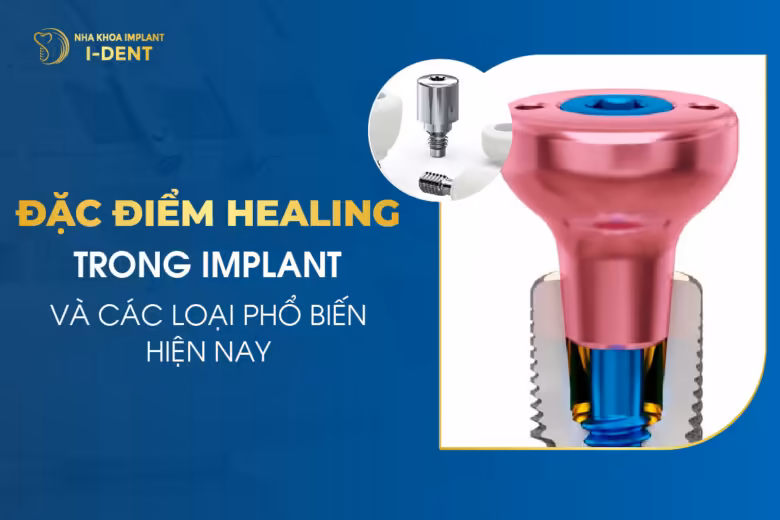 Đặc Điểm Healing Trong Implant Và Các Loại Phổ Biến Hiện Nay