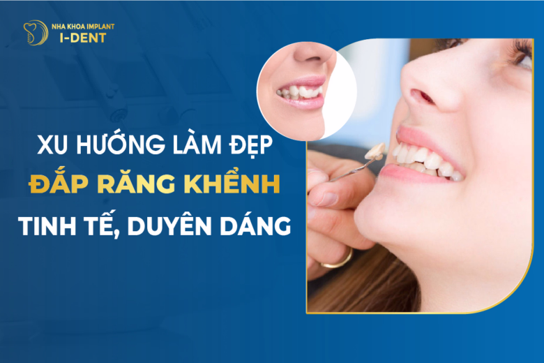 Đắp Răng Khểnh - Xu Hướng Làm Đẹp Tinh Tế, Duyên Dáng