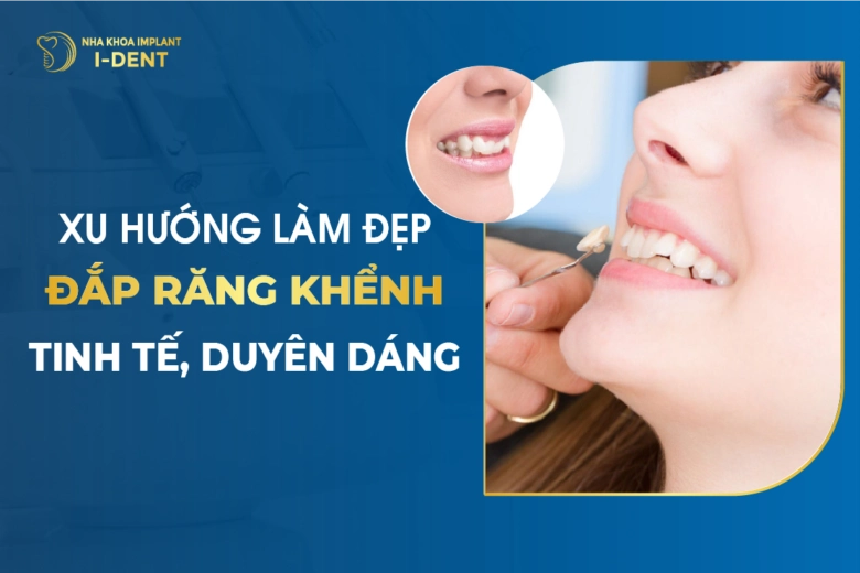 Đắp Răng Khểnh - Xu Hướng Làm Đẹp Tinh Tế, Duyên Dáng