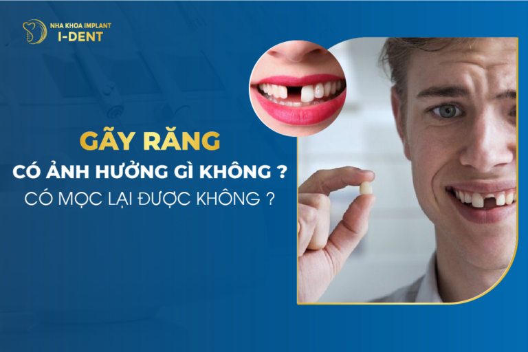 gãy răng hàm có sao không