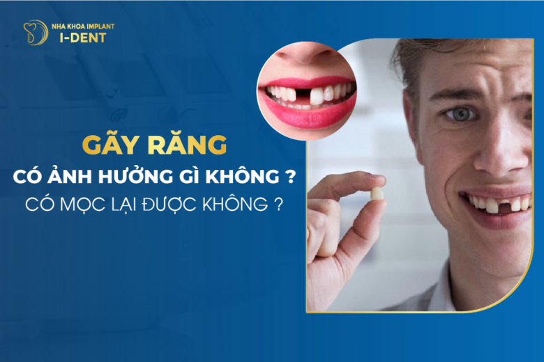 gãy răng hàm có sao không