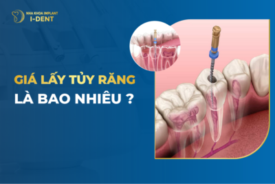 Dấu Hiệu Nhận Biết Bệnh Viêm Tủy Răng