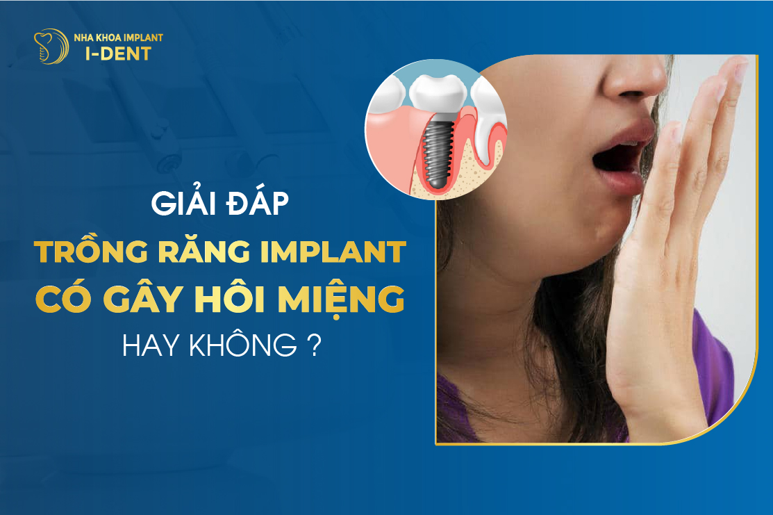 Giải Đáp Trồng Răng Implant Có Gây Hôi Miệng Hay Không?