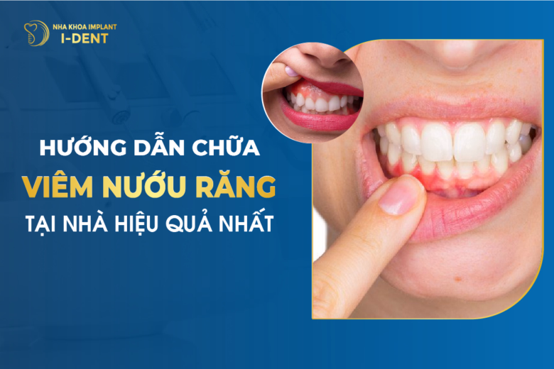 Hướng Dẫn Cách Chữa Viêm Nướu Răng Tại Nhà Hiệu Quả Nhất