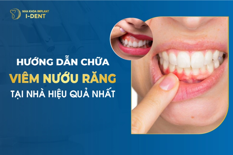 Hướng Dẫn Cách Chữa Viêm Nướu Răng Tại Nhà Hiệu Quả Nhất