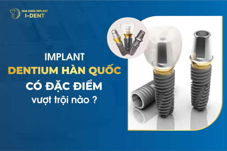 Implant Dentium Hàn Quốc Có Đặc Điểm Vượt Trội Nào?