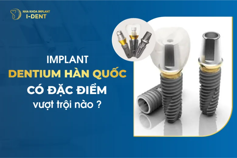 Implant Dentium Hàn Quốc Có Đặc Điểm Vượt Trội Nào?