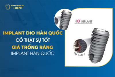 Implant Dio Hàn Quốc Có Thật Sự Tốt - Giá Trồng Răng Implant Hàn Quốc