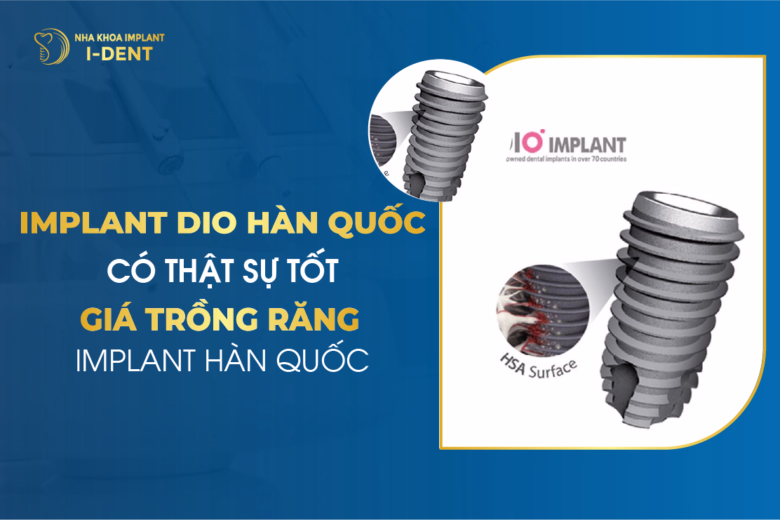 Implant Dio Hàn Quốc Có Thật Sự Tốt - Giá Trồng Răng Implant Hàn Quốc