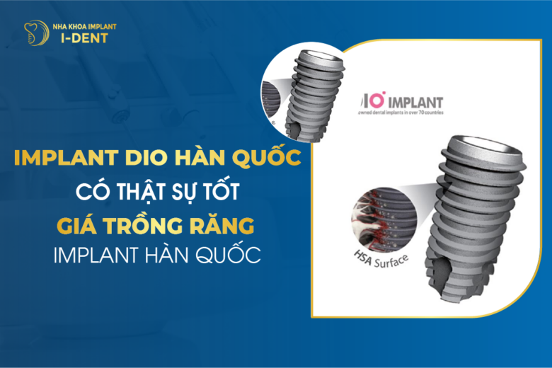 Implant DiO Hàn Quốc Có Thật Sự Tốt – Giá Trồng Răng Implant Hàn Quốc