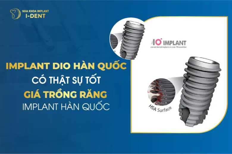 Implant Dio Hàn Quốc Có Thật Sự Tốt - Giá Trồng Răng Implant Hàn Quốc