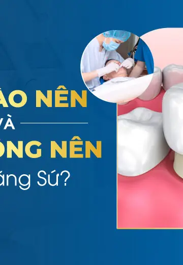 Khi Nào Nên Và Không Nên Bọc Răng Sứ?