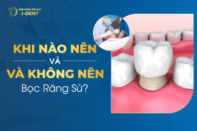 Khi Nào Nên Và Không Nên Bọc Răng Sứ?