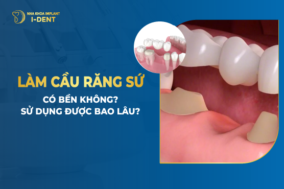 Cầu Răng Sứ Là Gì? Trồng Răng Sứ Có Đau Không?