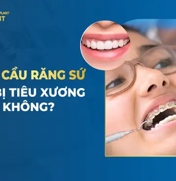 làm cầu răng sứ có bị tiêu xương không