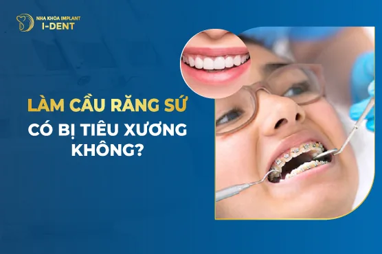 làm cầu răng sứ có bị tiêu xương không