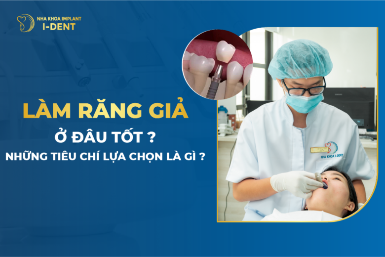 Làm Răng Giả Ở Đâu Tốt? Những Tiêu Chí Lựa Chọn Là Gì?