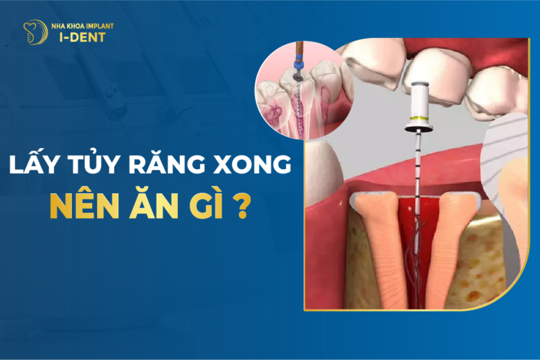 Lấy Tủy Răng Xong Nên Ăn Gì