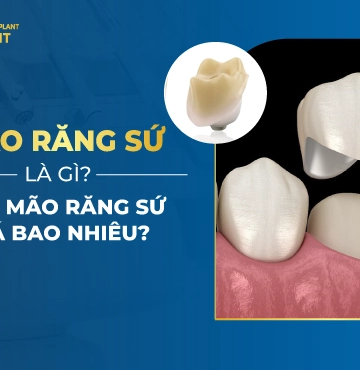 Mão Răng Sứ Là Gì? Bọc Mão Răng Sứ Giá Bao Nhiêu?