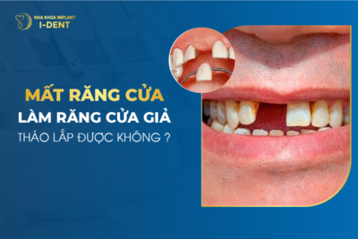 mất răng cửa
