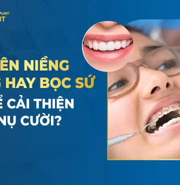 nên niềng răng hay bọc sứ