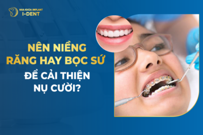 nên niềng răng hay bọc sứ