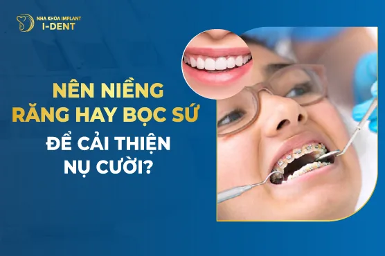 nên niềng răng hay bọc sứ