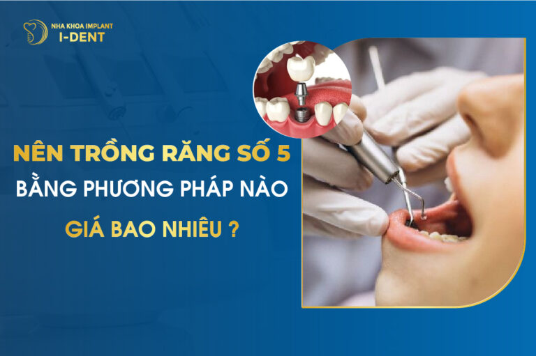 Nên trồng răng số 5 bằng phương pháp nào và giá bao nhiêu