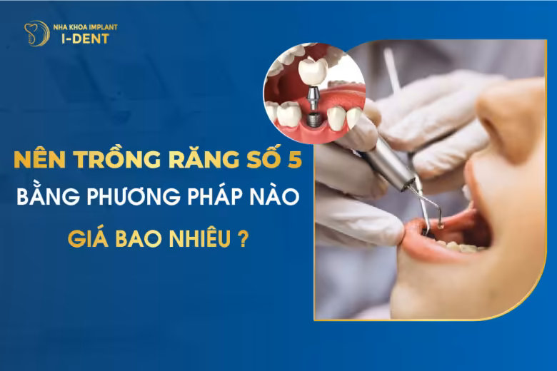 Nên trồng răng số 5 bằng phương pháp nào và giá bao nhiêu