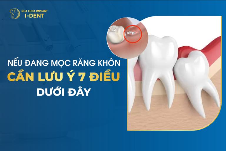 Nếu Đang Mọc Răng Khôn, Cần Lưu Ý 7 Điều Dưới Đây