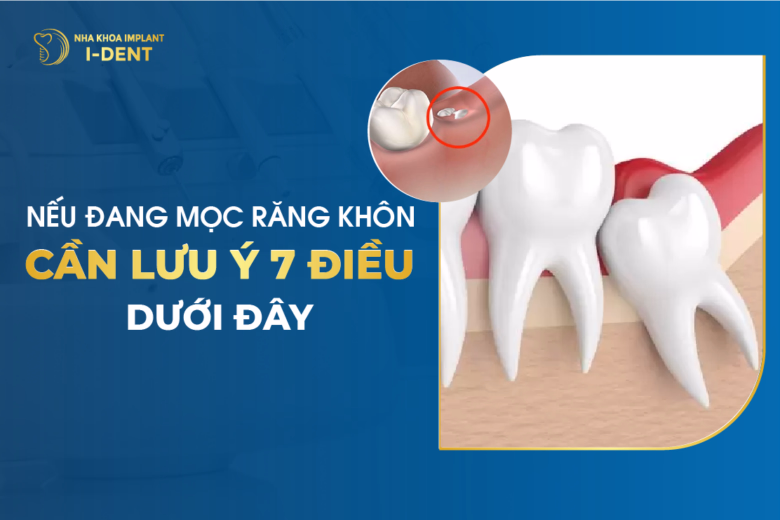 Nếu Đang Mọc Răng Khôn, Cần Lưu Ý 7 Điều Dưới Đây
