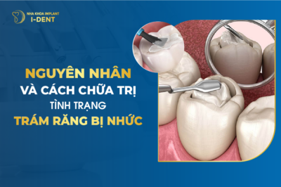 Nguyên Nhân Và Cách Chữa Trị Tình Trạng Trám Răng Bị Nhức