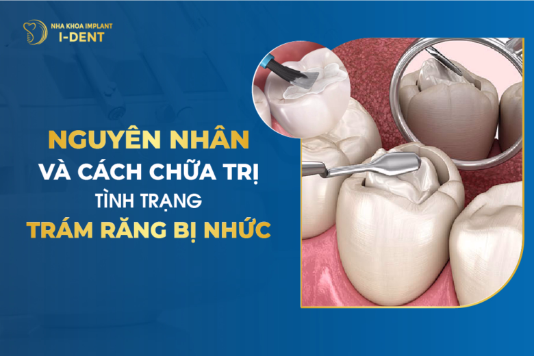 Nguyên Nhân Và Cách Chữa Trị Tình Trạng Trám Răng Bị Nhức