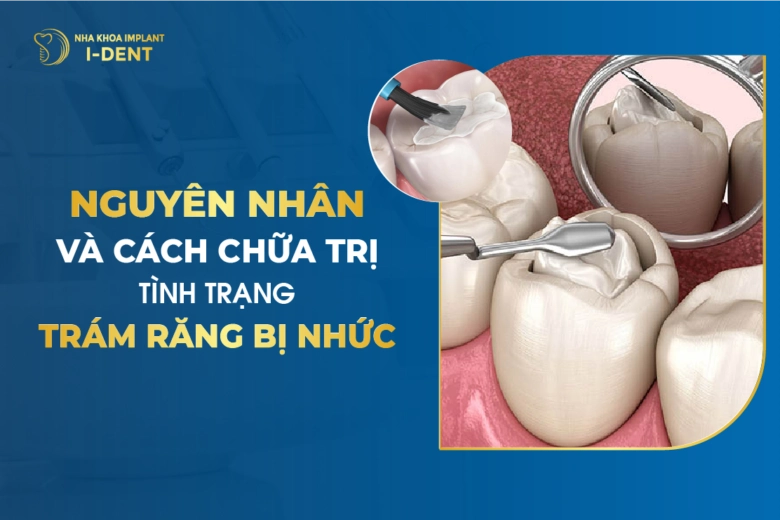 Nguyên Nhân Và Cách Chữa Trị Tình Trạng Trám Răng Bị Nhức