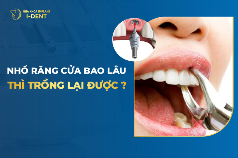 nhổ răng bao lâu thì trồng lại được