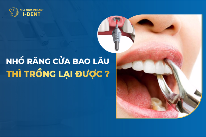 nhổ răng bao lâu thì trồng lại được