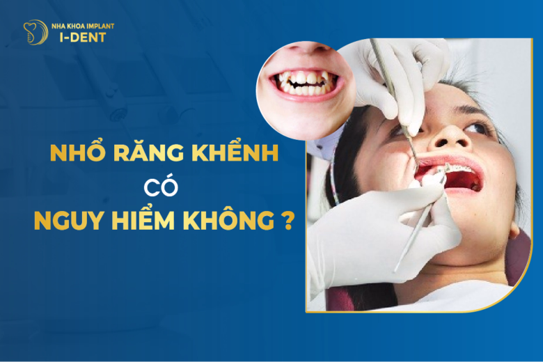 Nhổ Răng Khểnh Có Nguy Hiểm Không
