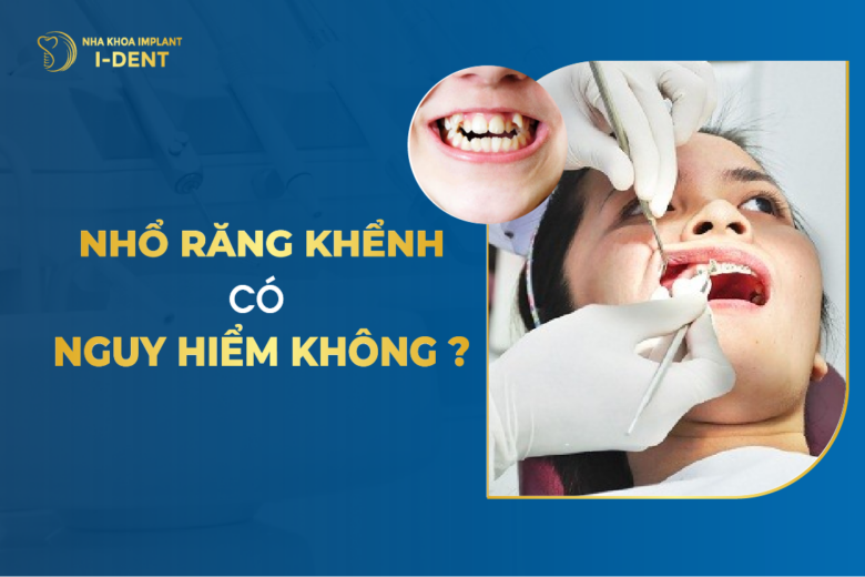 Nhổ Răng Khểnh Có Nguy Hiểm Không?