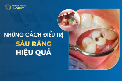 15 Cách Trị Sâu Răng Tại Nhà Nhanh Chóng Hiệu Quả