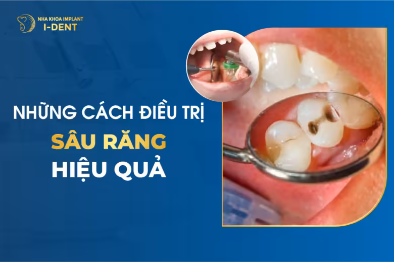 15 Cách Trị Sâu Răng Tại Nhà Nhanh Chóng Hiệu Quả