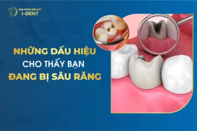 Những Dấu Hiệu Cho Thấy Bạn Đang Bị Sâu Răng
