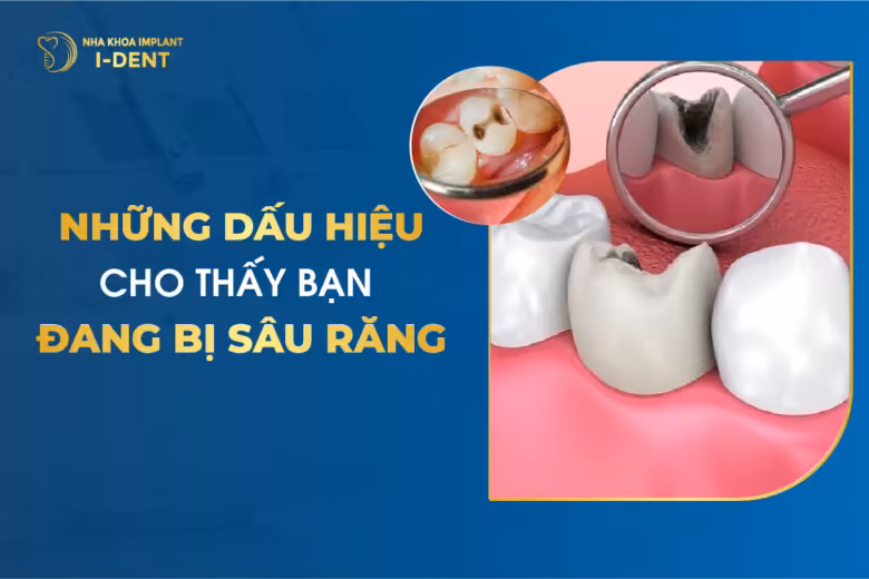 Những Dấu Hiệu Cho Thấy Bạn Đang Bị Sâu Răng