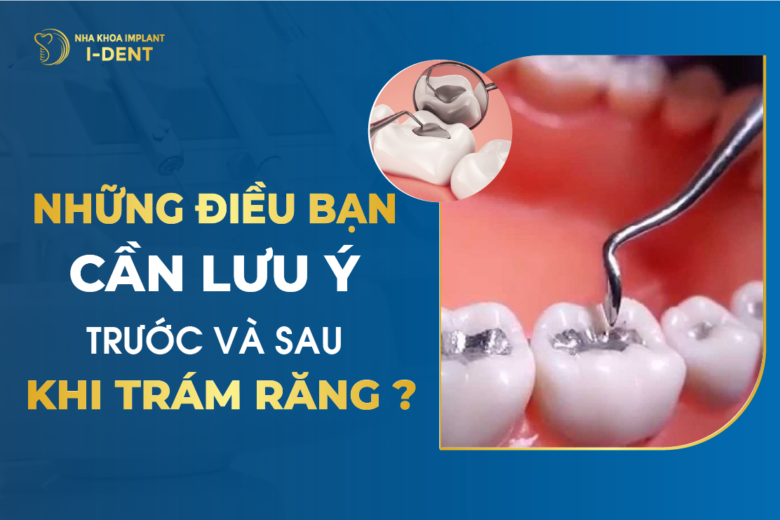 Những Điều Bạn Cần Lưu Ý Trước Và Sau Khi Trám Răng