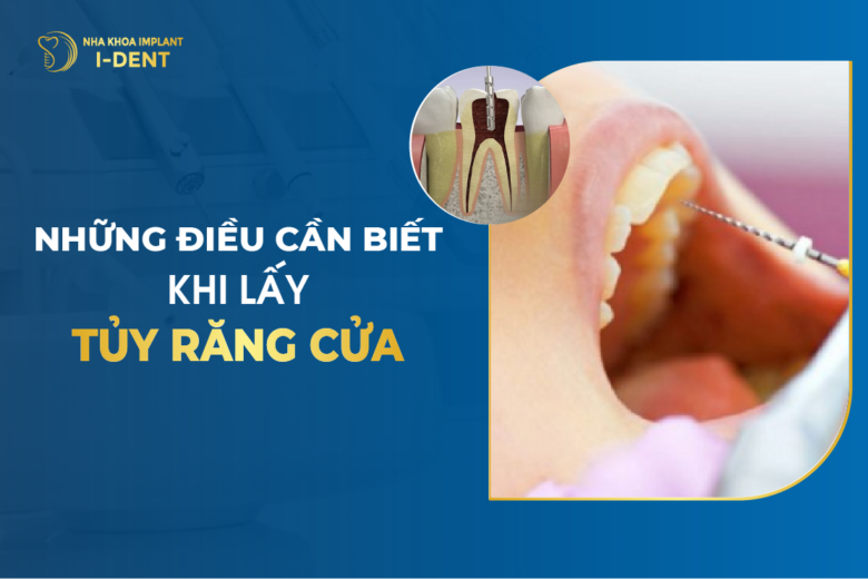 Những Điều Cần Biết Khi Lấy Tủy Răng Cửa