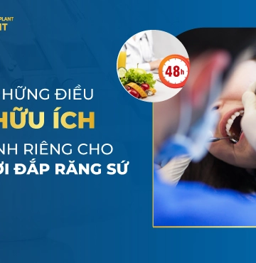 Những Điều Hữu Ích Dành Riêng Cho Người Đắp Răng Sứ