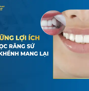 Những Lợi Ích Bọc Răng Sứ Răng Khểnh Mang Lại