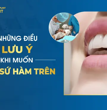 Những Lưu Ý Khi Muốn Bọc Sứ Hàm Trên