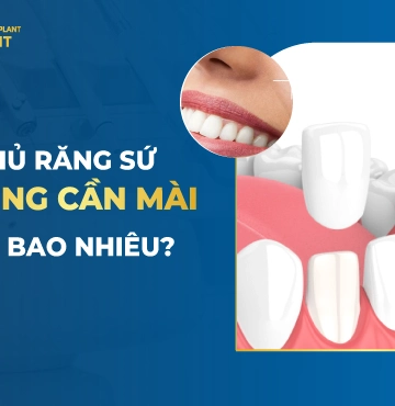 Phủ Răng Sứ Không Cần Mài Giá Bao Nhiêu?